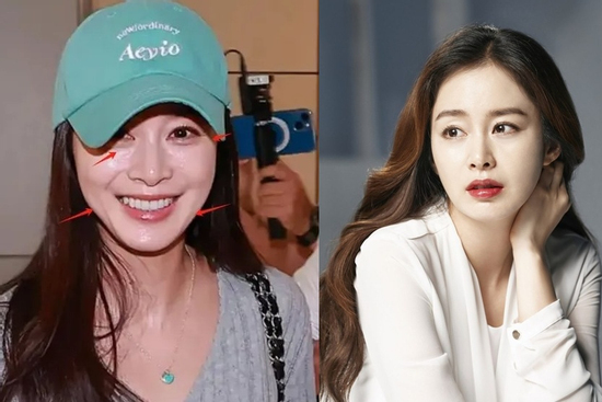 Kim Tae Hee nói về gương mặt cứng đờ, nhan sắc xuống cấp