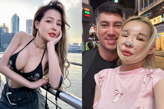 Ngân 98 đáp trả gây sốc khi bị mỉa mai ngoại hình 'toàn đồ giả'