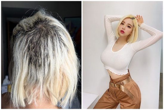 DJ Soda gây sốc với mái tóc rụng nửa đầu, hư hại nghiêm trọng vì tẩy