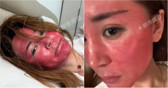 Khuôn mặt của người phụ nữ 22 năm không tẩy trang gây sốc