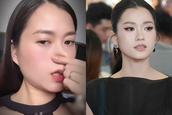 Bị nghi mới 'dao kéo' vì nhan sắc lạ hoắc, Lâm Vỹ Dạ có hành động khiến netizen câm nín