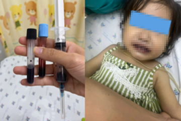 Máu của bé gái chuyển màu nâu đen sau khi ăn canh nấu bằng nước giếng