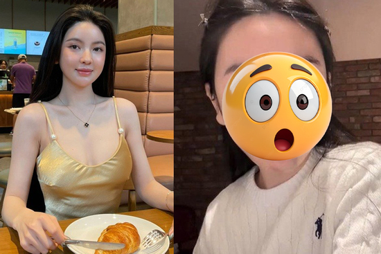 Vợ Quang Hải bị biến chứng thẩm mỹ phải sang Hàn Quốc điều trị, diện mạo hiện tại mới sốc