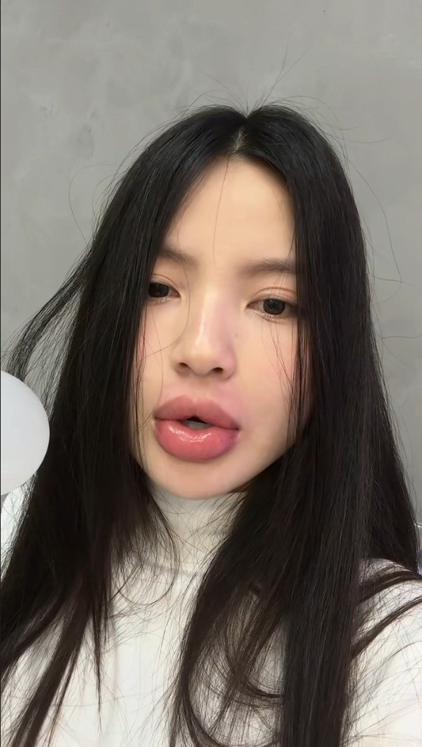 Trước khi tiết lộ bị biến chứng thẩm mỹ giật mình diện mạo vợ Quang Hải qua cam thường