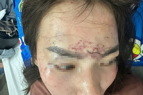 Khởi tố hai người phụ nữ vụ 'tra tấn' bằng axit và máy xăm