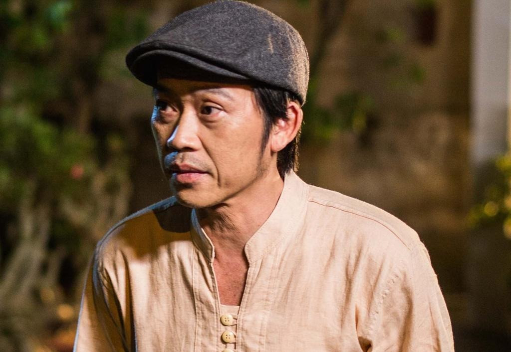 Bức ảnh tiết lộ tình trạng sức khỏe hiện tại của Hoài Linh