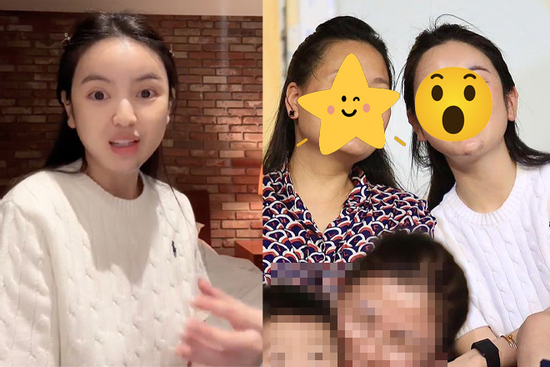 Chu Thanh Huyền lộ diện sau biến chứng thẩm mỹ, diện mạo hiện tại gây sốc