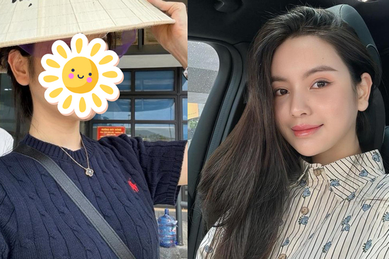 Giật mình mặt mộc của vợ Quang Hải sau khi bị biến chứng vì thẩm mỹ quá đà