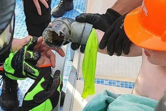 Bé trai 4 tuổi suýt mất cánh tay vì bị hút vào hệ thống lọc nước hồ bơi