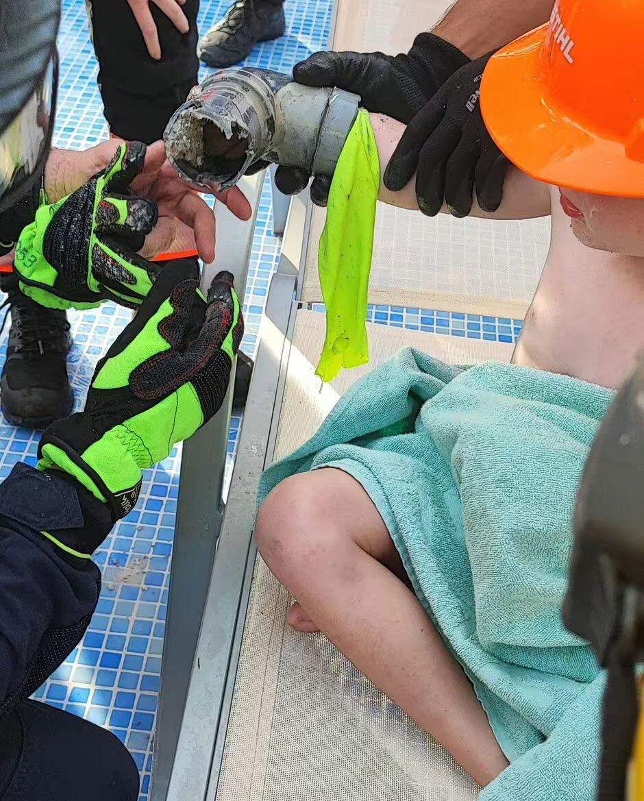 Bé 4 tuổi bị hút tay vào lỗ không che chắn ở hồ bơi ở Tây Ban Nha. (Ảnh: Bombers de Mallorca)