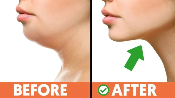 Mẹo massage mặt đúng cách giúp giảm nọng cằm dễ áp dụng hàng ngày - Ảnh 5