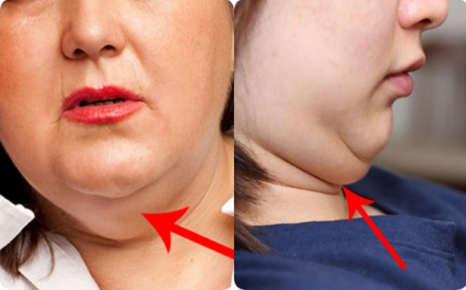 Mẹo massage mặt đúng cách giúp giảm nọng cằm dễ áp dụng hàng ngày - Ảnh 1