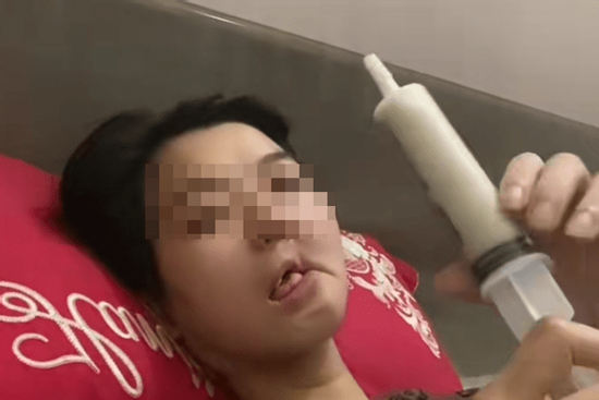 Hình ảnh cô gái mắc ung thư xương hàm, bữa ăn hàng ngày là 'cháo xay loãng ăn bằng xi lanh' gây xót xa