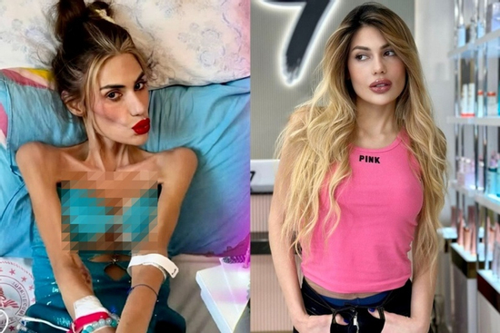 Mắc chứng biếng ăn, mỹ nhân truyền hình giảm 40kg trong 2 năm, qua đời thương tâm ở tuổi 30