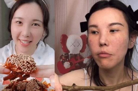 Mặt nữ mukbang biến dạng nghiêm trọng sau 2 năm hành nghề