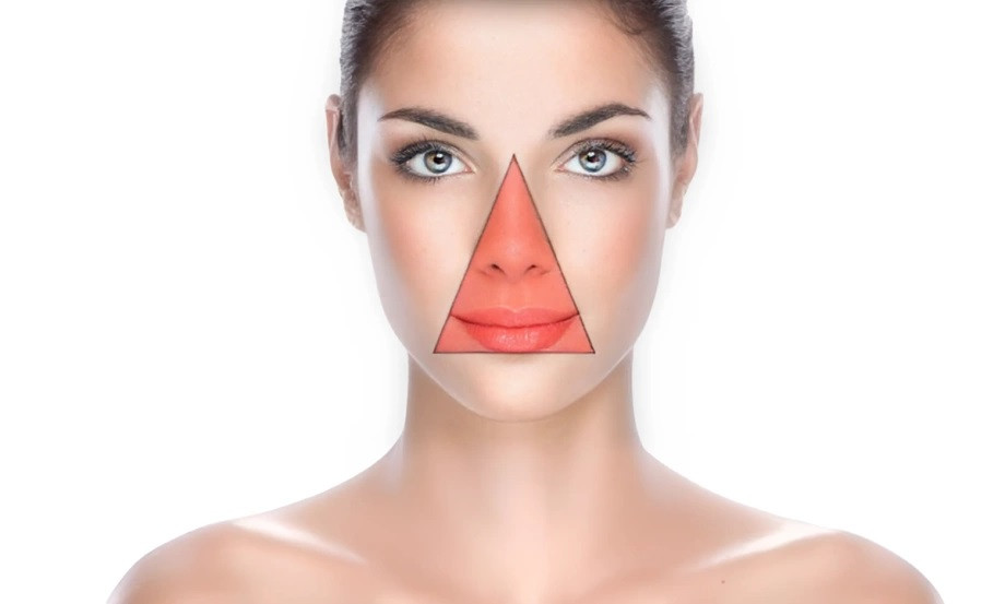 Nguy cơ tử vong từ thói quen tự nặn mụn - Ảnh 2.