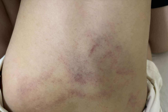 Bé gái bị đánh, kéo lê ở trường mầm non Hà Nội: Tạm đình chỉ giáo viên chứng kiến nhưng mặc kệ