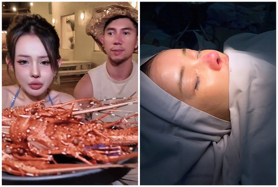 Ngân 98 gây tranh cãi khi mũi thẩm mỹ nhiễm trùng nặng còn ăn hải sản?