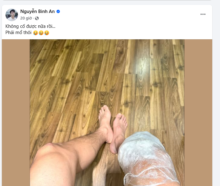 Diễn viên Bình An lên bàn mổ sau 1 năm chấn thương nghiêm trọng