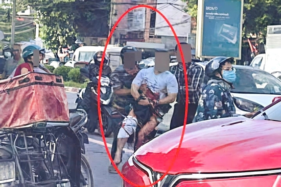 Nam TikToker ở Thái Nguyên bị chém gần đứt lìa bàn tay: Bác sĩ thông báo tin quan trọng