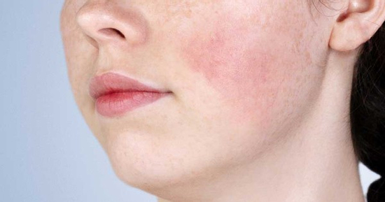 7 tác dụng phụ thường gặp khi sử dụng retinol