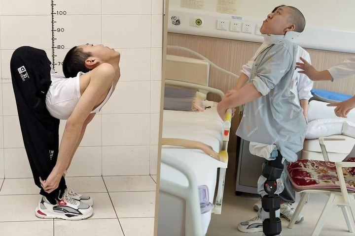 Hành trình duỗi thẳng lưng cho chàng trai có cột sống cong hình chữ Z đầy khó khăn.
