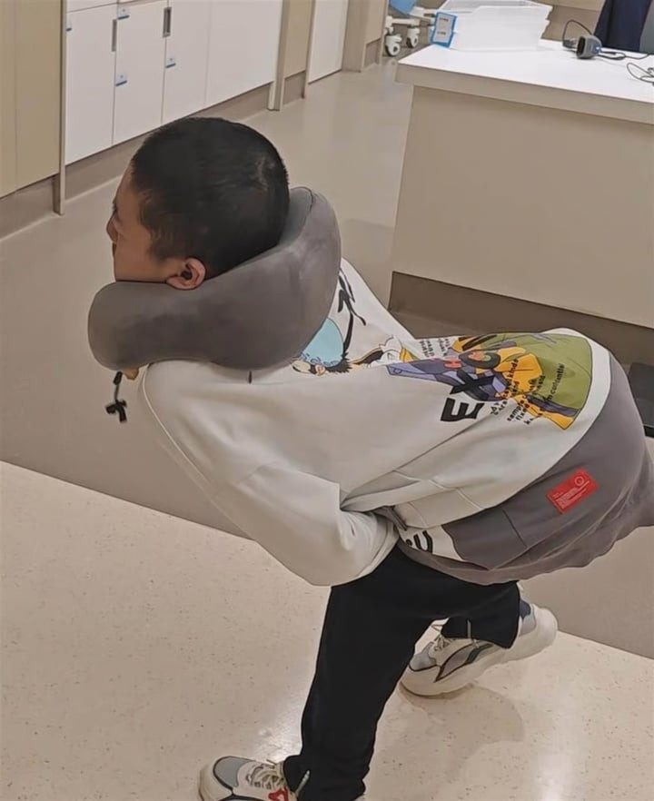 Jiang bị viêm cột sống dính khớp khiến cổ cong về phía sau, cơ thể có hình chữ Z.