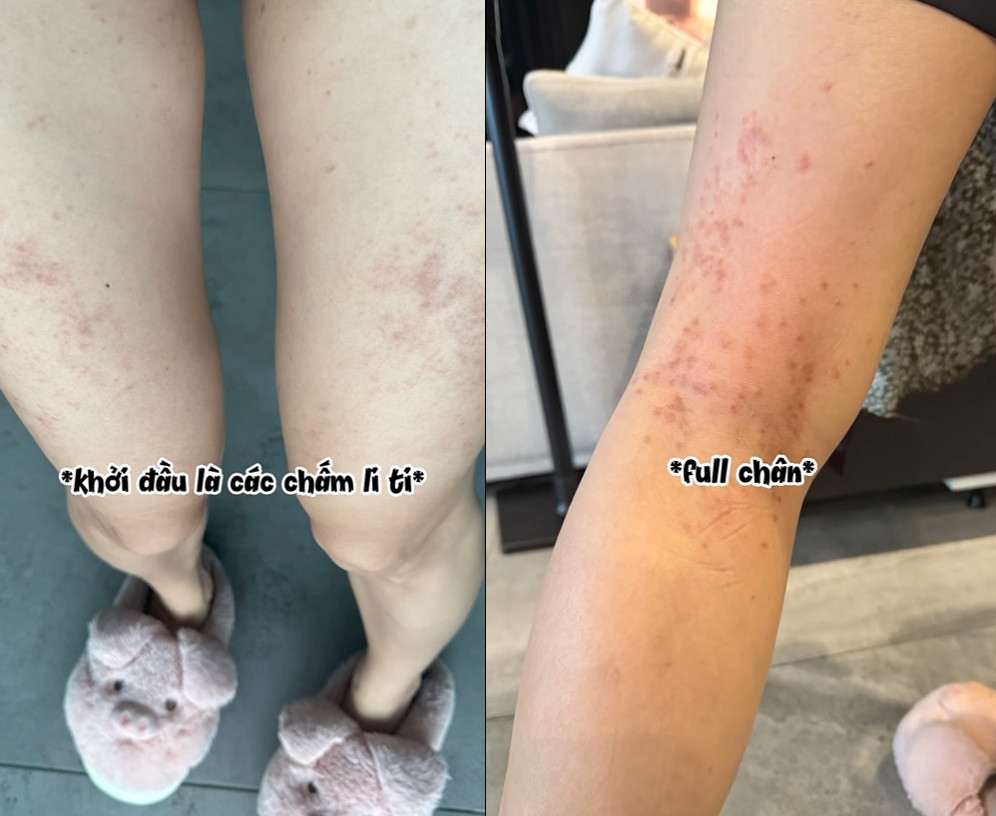 Sức khỏe gây lo lắng của Ngô Thanh Vân khi mang thai