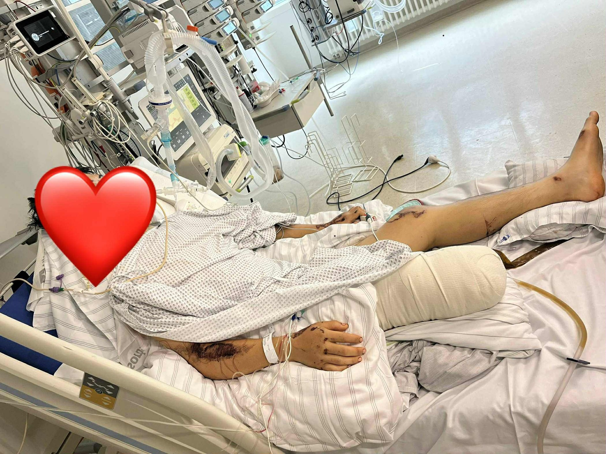 928681671753126295553645r 1753174574332 17531745745351223572020 1753177981306228930647 1753180641565 17531806417092061286092