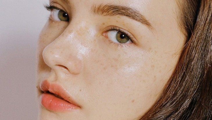 Trị nám bằng nguyên liệu tự nhiên có hiệu quả không?- Ảnh 1.