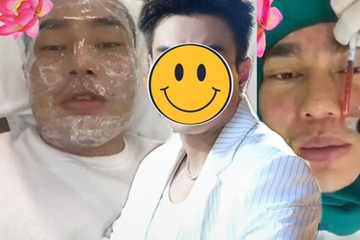 Sao nam Việt nghiện phẫu thuật thẩm mỹ: Từng cứ 10 ngày lại đi chỉnh sửa 1 lần, bị tụt sụn mũi khi đang chạy bộ