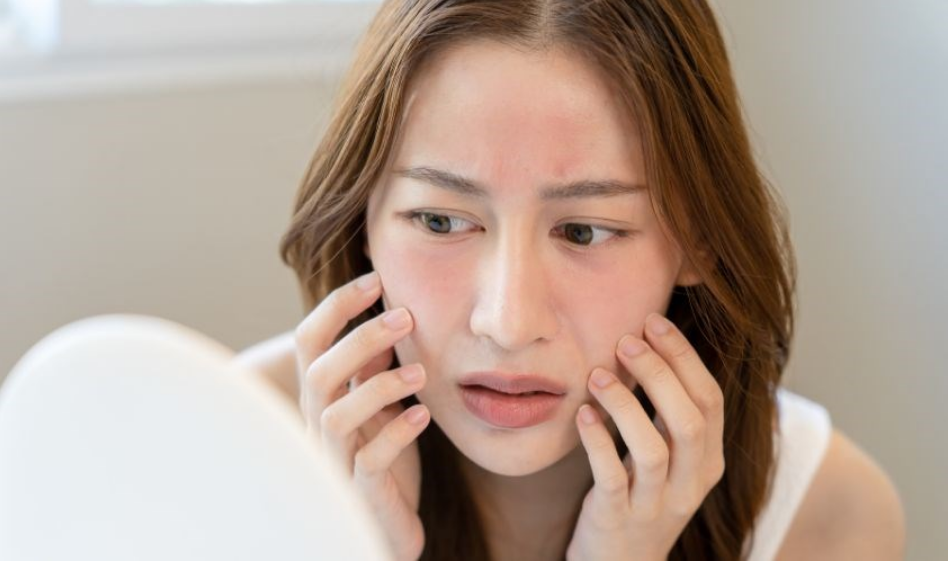 Tránh 3 thành phần này trên mặt nếu bạn có làn da nhạy cảm - Ảnh 1