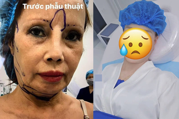 'Cô dâu Cao Bằng' lại thẩm mỹ ở tuổi U70, diện mạo sau 'can thiệp' mới sốc