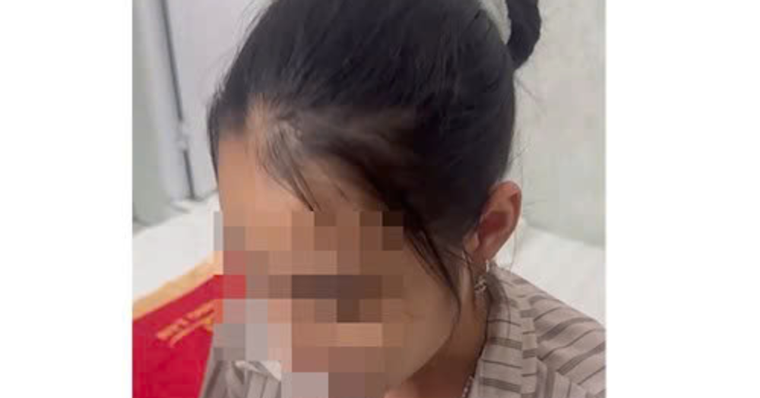 Dính bẫy lừa quen thuộc, nữ sinh nghe điện thoại rồi 'răm rắp' vào khách sạn