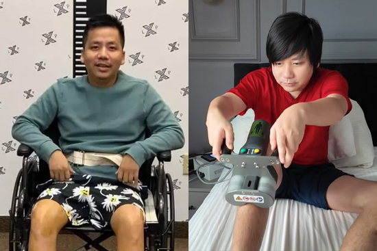 Khoa Pug chi 3 tỷ đi kéo dài chân, tiết lộ lý do 'dao kéo' khiến nhiều người sốc