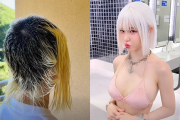 Tình trạng hiện tại của DJ Soda sau sự cố kinh hoàng, trụi cả mảng đầu vì tẩy tóc