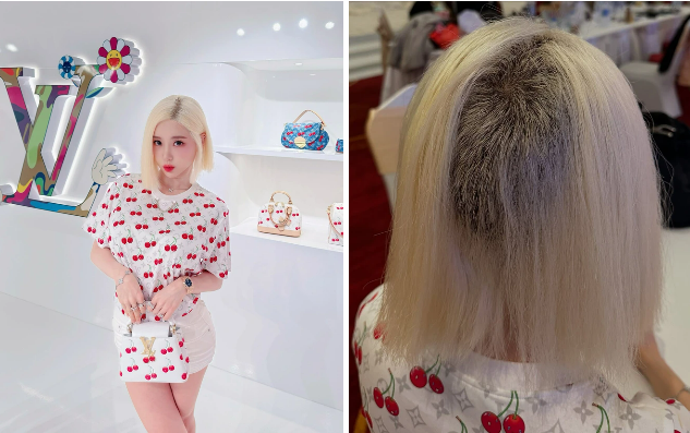 Tình trạng hiện tại của DJ Soda sau sự cố trụi cả mảng đầu vì tẩy tóc