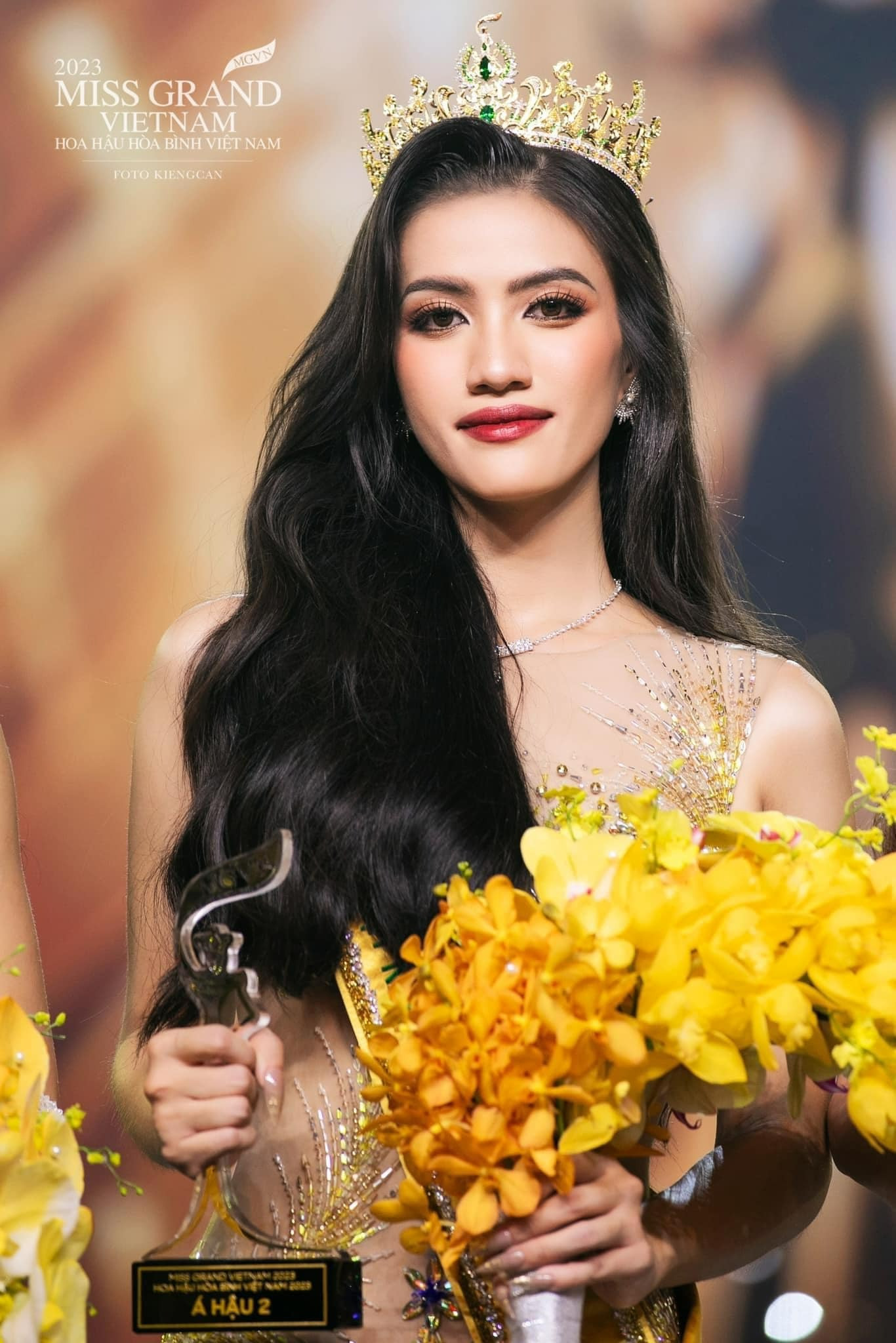 Á hậu Vbiz mắc u cột sống ở tuổi 24 6 tiếng nằm phẫu thuật nhận kết quả bất ngờ