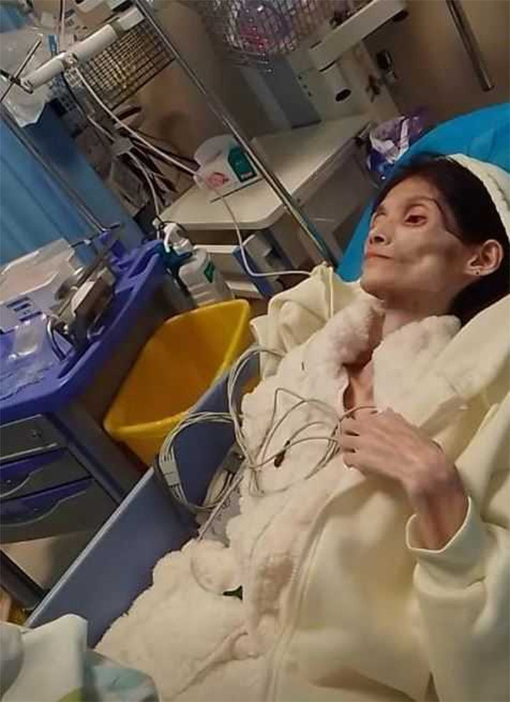 Kiều Kiều hiện tại trông như một bộ xương di động.