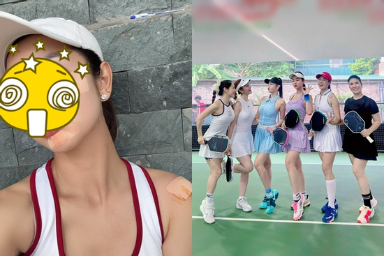 1 Hoa hậu đình đám Vbiz gặp tai nạn vì pickleball, gương mặt chi chít băng gạc