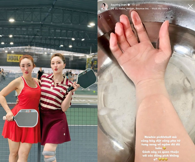 1 Hoa hậu đình đám Vbiz gặp tai nạn vì pickleball gương mặt chi chít băng gạc