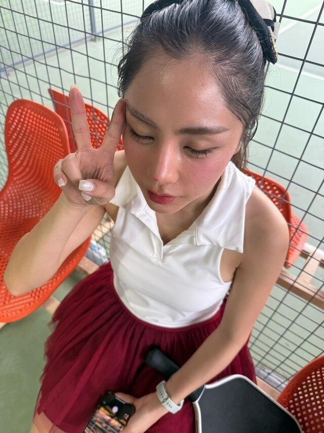 1 Hoa hậu đình đám Vbiz hỏng mặt vì pickleball gương mặt chi chít băng gạc