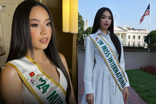 Hoa hậu Thanh Thủy lên tiếng khi bị ekip Mỹ 'hại' khiến mặt sưng phồng, già đi chục tuổi