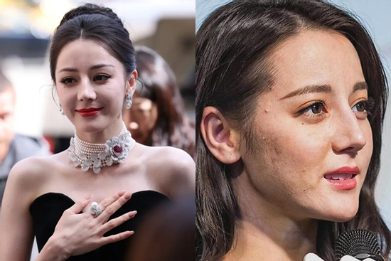 Địch Lệ Nhiệt Ba lộ làn da sần sùi, chi chít khuyết điểm qua cam thường