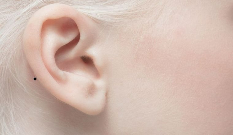 Bí mật thú vị về nốt ruồi trên tai Bất ngờ số 2 khiến ai cũng giật mình