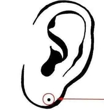 Bí mật thú vị về nốt ruồi trên tai Bất ngờ số 2 khiến ai cũng giật mình