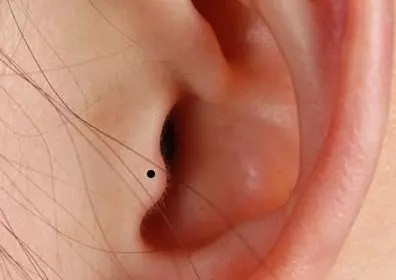 Bí mật thú vị về nốt ruồi trên tai Bất ngờ số 2 khiến ai cũng giật mình