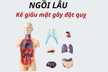 Đột quỵ và hội chứng ‘ngồi lâu’: Nguy hiểm hơn bạn tưởng