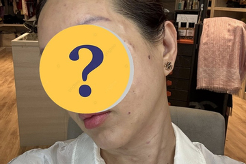 Không nhận ra Hoa hậu Vbiz với mặt mộc U50 'tiêm sửa trăm mũi', tự nhận nhìn thấy ghê