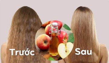 Loại ‘thần dược’ dành cho mái tóc, đặc biệt là các vấn đề ngứa da đầu, gãy tóc